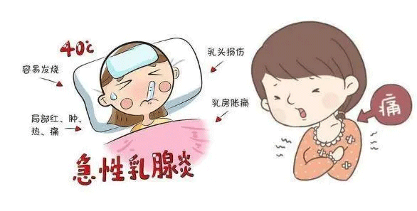 如何防治急性乳腺炎？