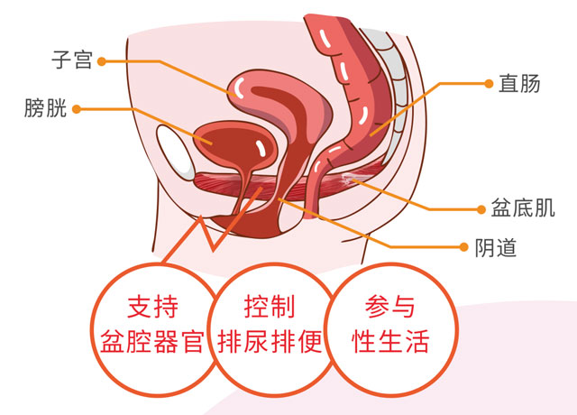 女性漏尿，趕緊查查盆底功能是否出了問題！